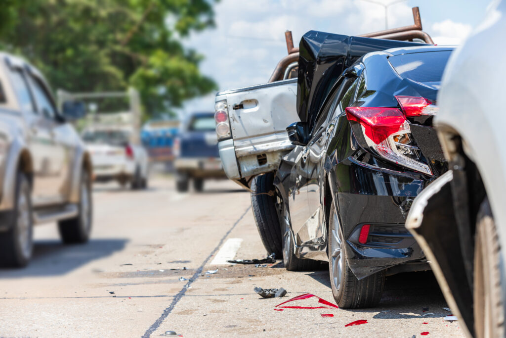 10 Common Types of Claims After a Serious Car Accident