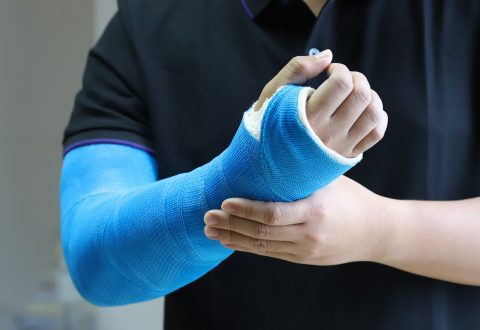 Can Broken Bones Be Considered Catastrophic Injuries?
