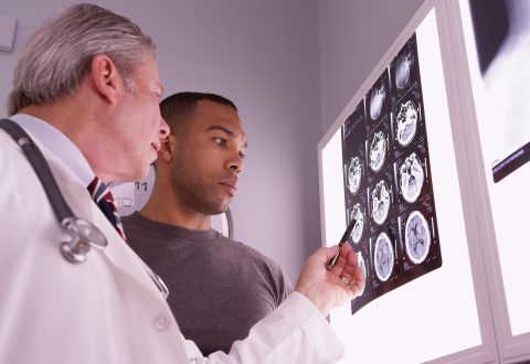 What to Consider When Calculating Damages for a Traumatic Brain Injury